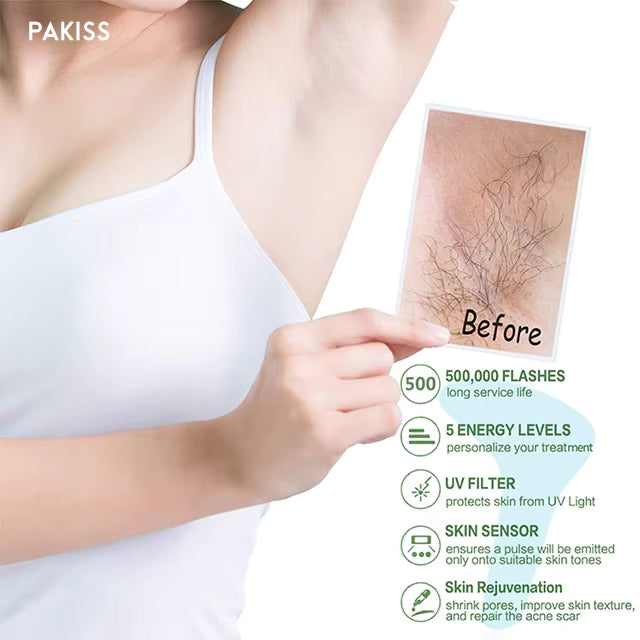 PARKISS  FY-B500-504- Silkglow Pro Portable IPL Hair Removal for Ladies